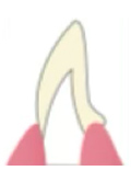 セラミック