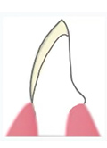 セラミック